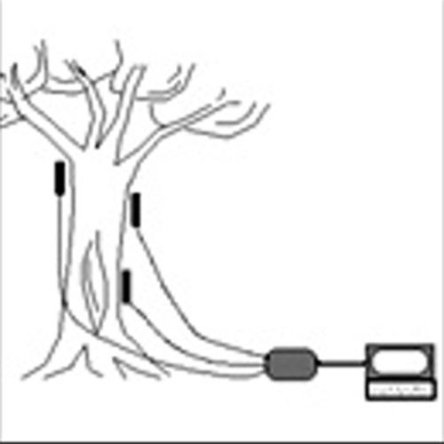 DYNATIM? DNT04 系列樹木負(fù)載測(cè)試儀